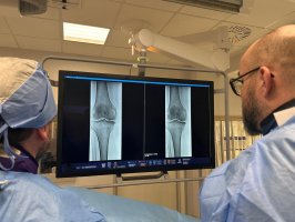 Nowatorska embolizacja kolan w Uniwersyteckim Szpitalu Klinicznym metodą TAME Nowatorska embolizacja kolan w Uniwersyteckim Szpitalu Klinicznym metodą TAME