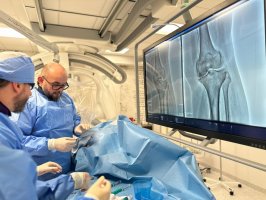 Nowatorska embolizacja kolan w Uniwersyteckim Szpitalu Klinicznym metodą TAME Nowatorska embolizacja kolan w Uniwersyteckim Szpitalu Klinicznym metodą TAME